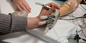 Ortopedia y traumatología el tema de una jornada en el Hospital Madariaga de Posadas el 9 de agosto 2019\u002E (CIMECO) foto ilustrativa\u002E