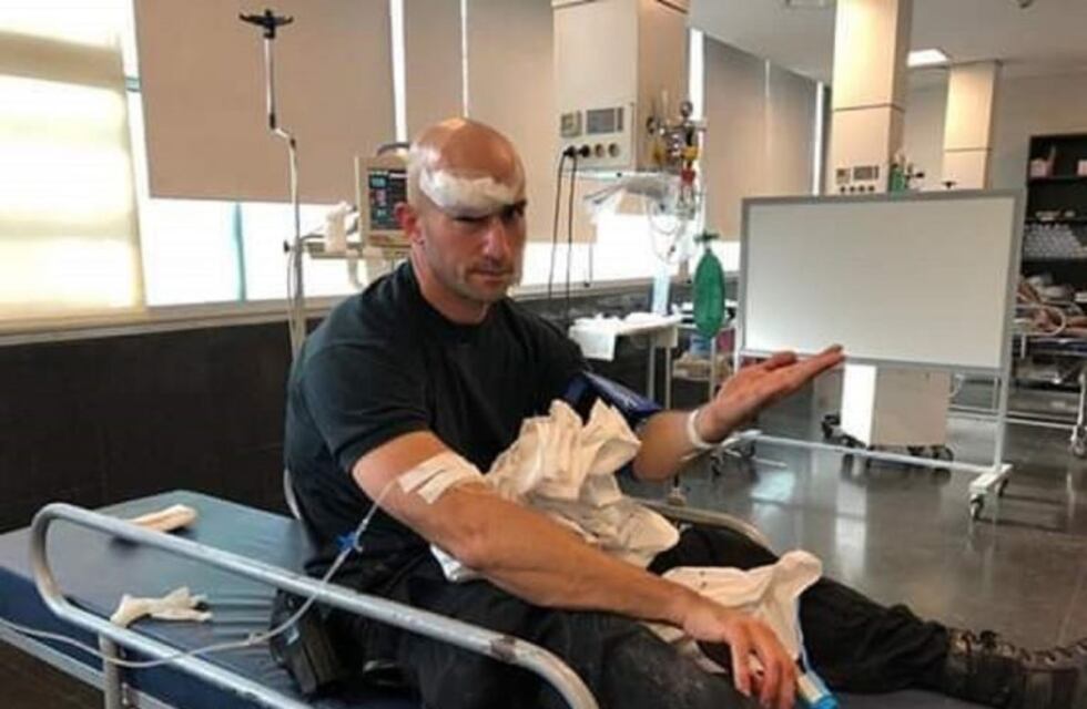 Policía agredido por vecinos sufrió fractura en la cabeza en zona oeste