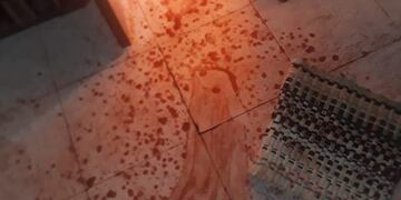 Un hombre que estaba con la víctima terminó apuñalado cuando la quiso defender\u002E