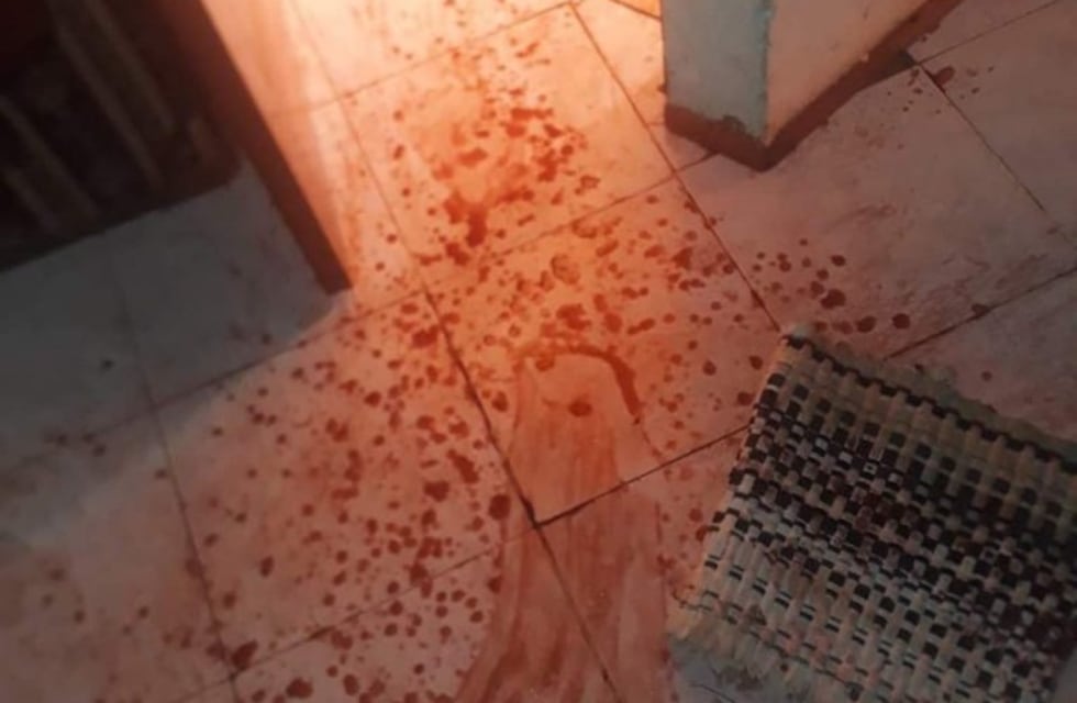 Intento de femicidio: saltó las rejas para no ser apuñalada por su ex