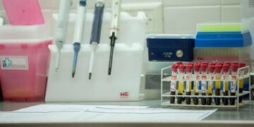 Coronavirus estudios en Rio Negro