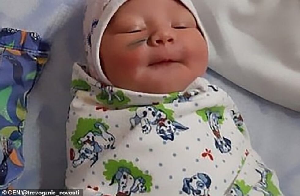 Insólito: los médicos lastimaron el rostro de una bebé durante la cesárea