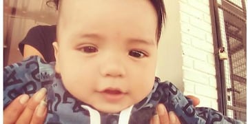 El pequeño Oliver tiene un año y dos meses y vive en Sebastián Elcano\u002E Fue atropellado por una camioneta municipal\u002E