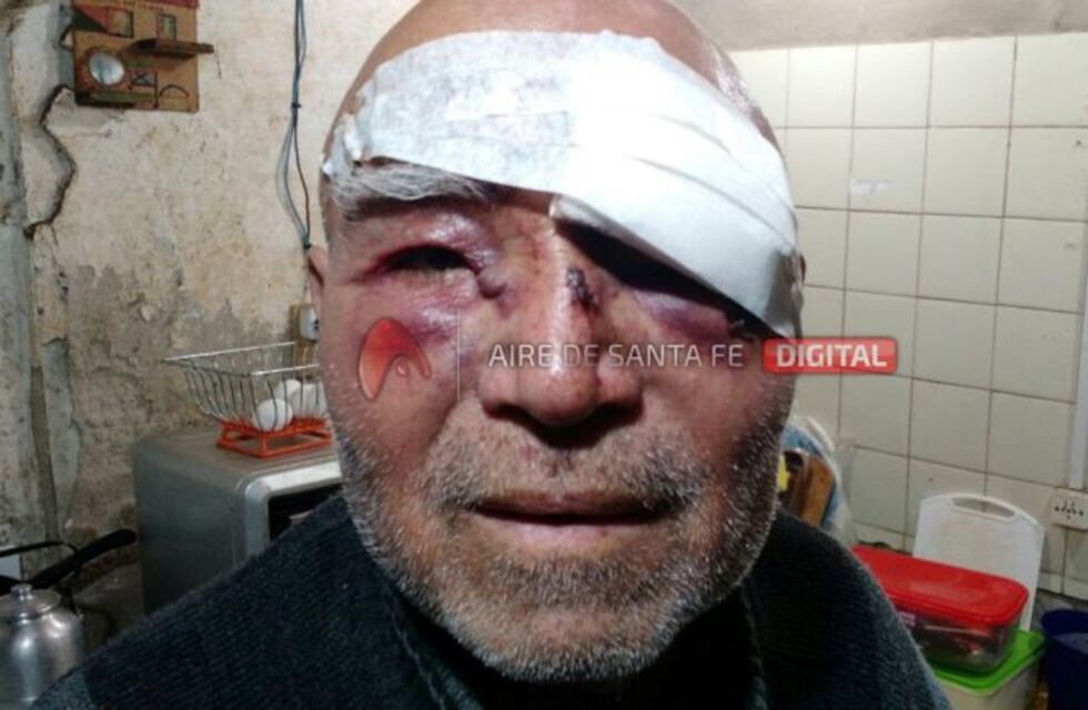 Intentó frenar una pelea y recibió un ladrillazo