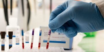 Covid-19: La Rioja tiene seis nuevos contagios y 75 casos activos