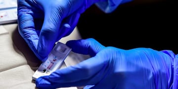 (Foto: RONALDO SCHEMIDT / AFP)