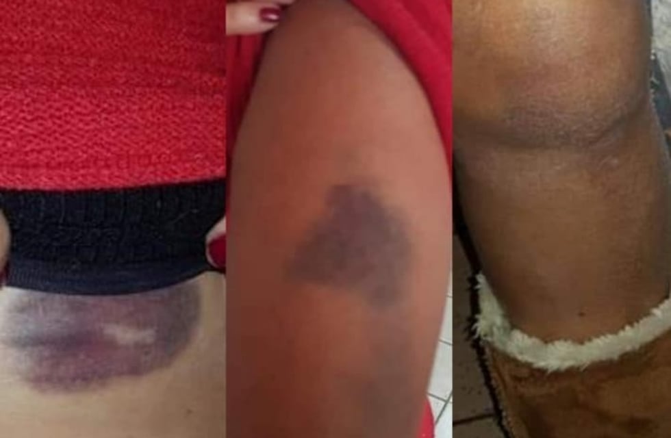 Ingresó a una casa, fue sorprendido por la propietaria y la golpeó para robarle