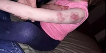 Una nena discapacitada fue brutalmente golpeada dentro de un micro escolar (Foto: web)