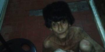 Un hombre fue denunciado por una vecina de Florencio Varela al observar que tiene a su madre desnuda y encerrada en un patio\u002E