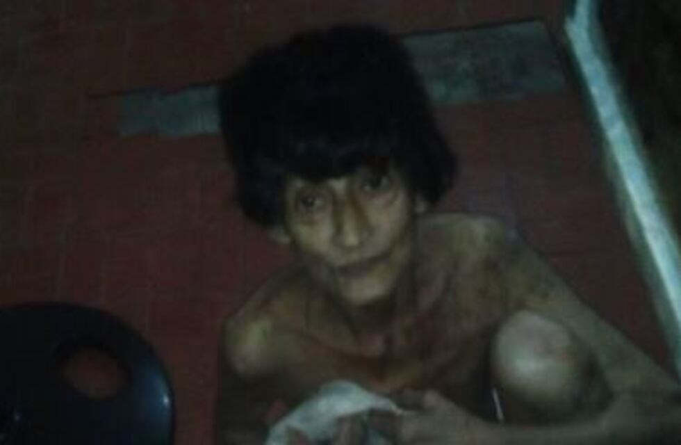 Florencio Varela: Denuncian a un hombre por tener a su madre desnuda y encerrada en un patio