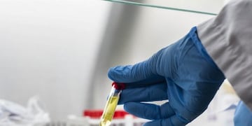 Argentina fabricará al menos 150 millones de las vacunas de Oxford