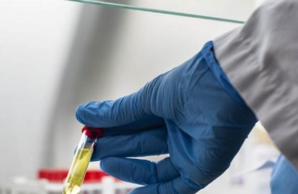 Argentina fabricará al menos 150 millones las vacunas de Oxford contra el coronavirus