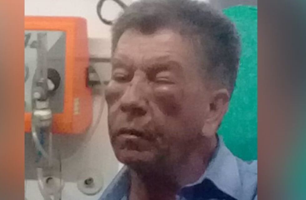 Le robaron y golpearon a un chofer de la 319