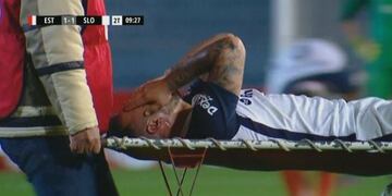 Franco Mussis sufrió rotura de ligamentos cruzados\u002E