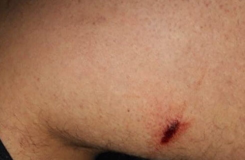 Los policías identificaban a un hombre y los atacó un Pitbull