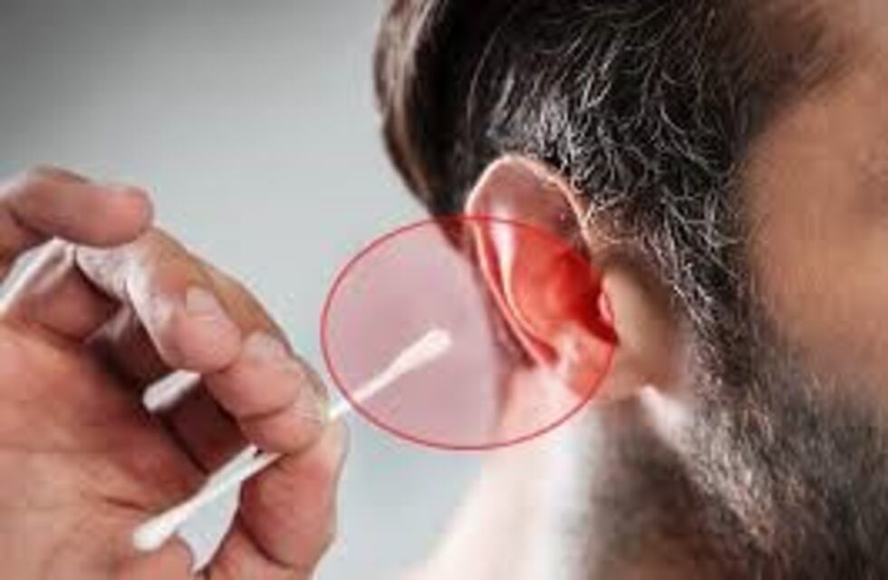 Le quedó algodón de un hisopo en el oído y terminó con una infección cerebral
