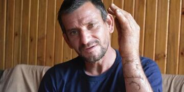 Ramón Alberto Espínola logró escapar de sus atacantes pero le costaría la movilidad en mano izquierda debido a las heridas recibidas\u002E