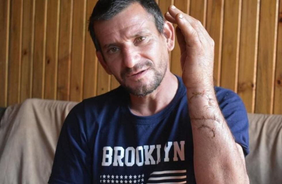 Trataron de asesinarlo y herido caminó seis kilómetros para salvarse