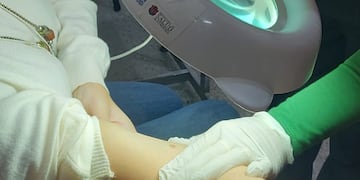 Campaña de prevención para el cáncer de piel
