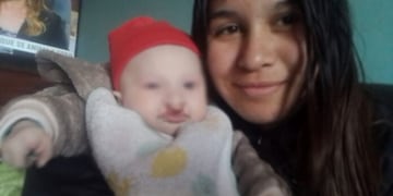 Ana y Liam, quién debe pasar por 5 cirugías antes de los 4 años.