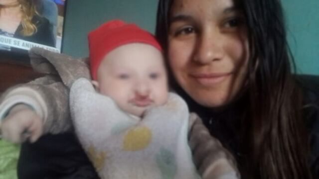 Ana y Liam, quién debe pasar por 5 cirugías antes de los 4 años.