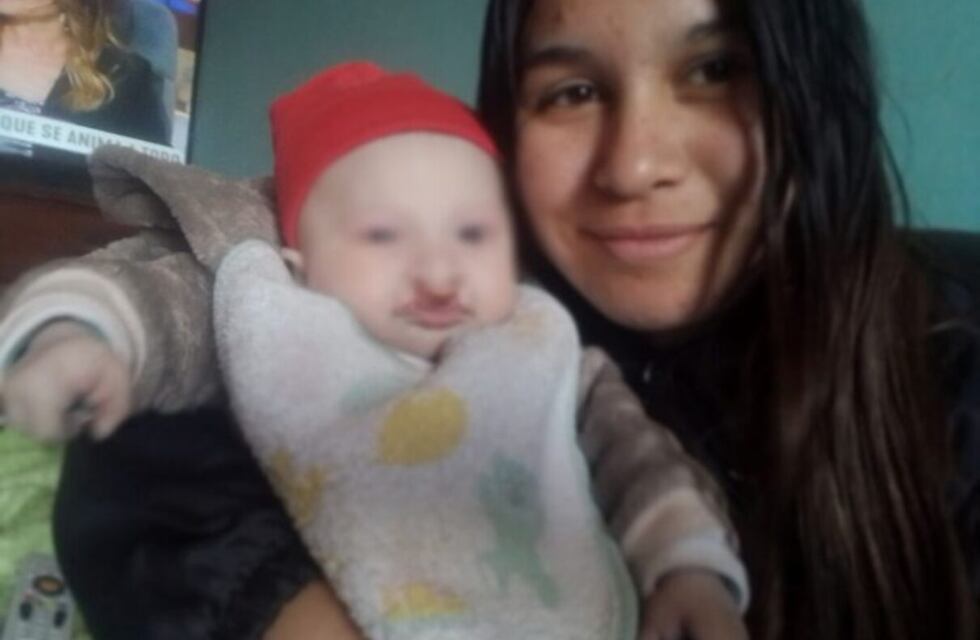 Liam, el pequeño sancarlino con Ectrodactilia que necesita ayuda para su cirugía