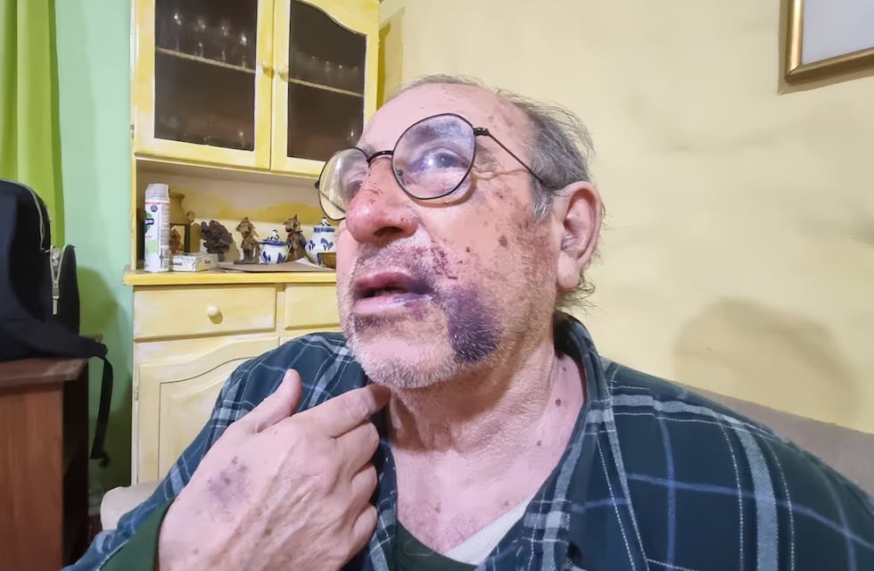 Indignación en Córdoba: asfixiaron a un hombre de 77 años para robarle