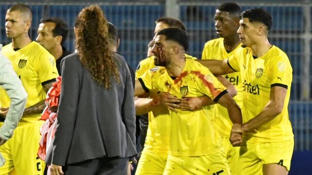 El futbolista uruguayo se fue de la cancha con la cara ensangrentada.