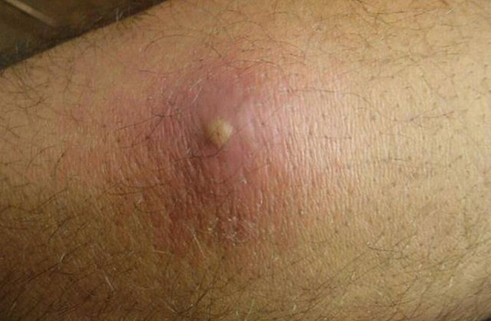 Piden extremar los cuidados para evitar la propagación de leishmaniasis canina en Córdoba: de qué se trata