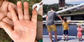 Peligroso puente peatonal y las secuelas en una beba\u002E