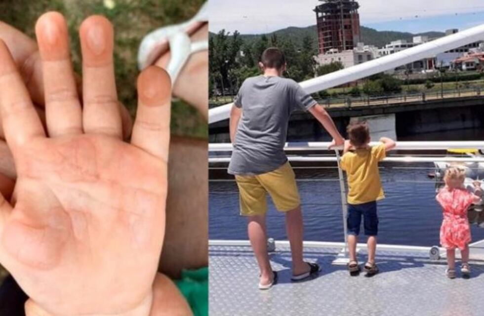 Habló la mamá de la beba quemada en el puente peatonal: "Se quería arrancar las manos y gritaba del dolor"