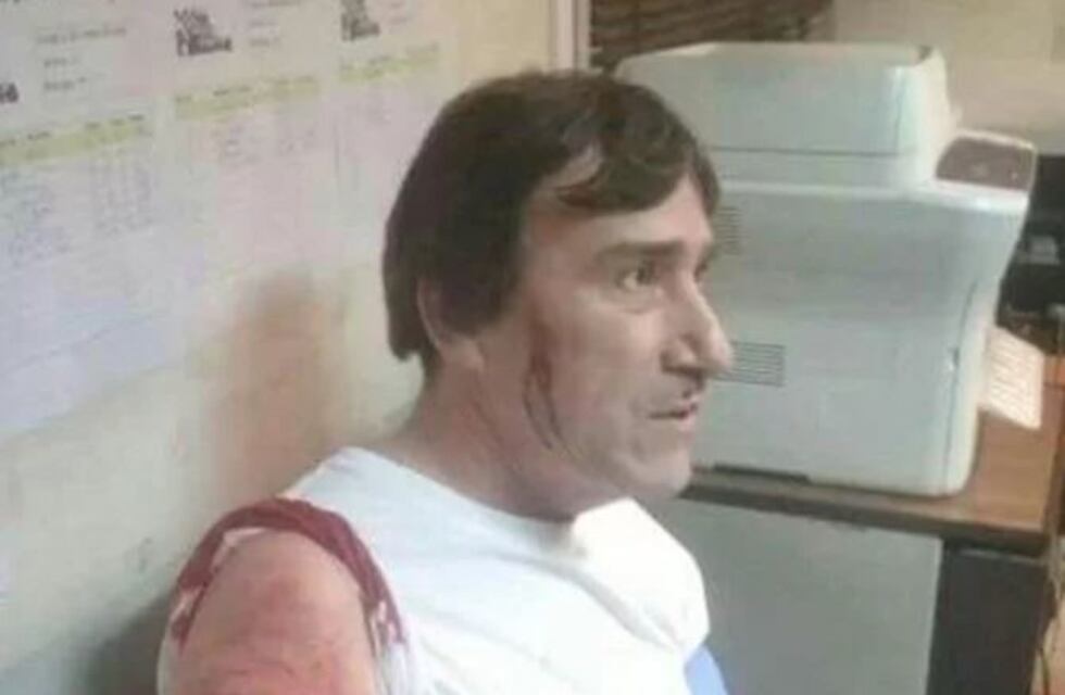Apuñalaron a un colectivero y hay paro en siete líneas