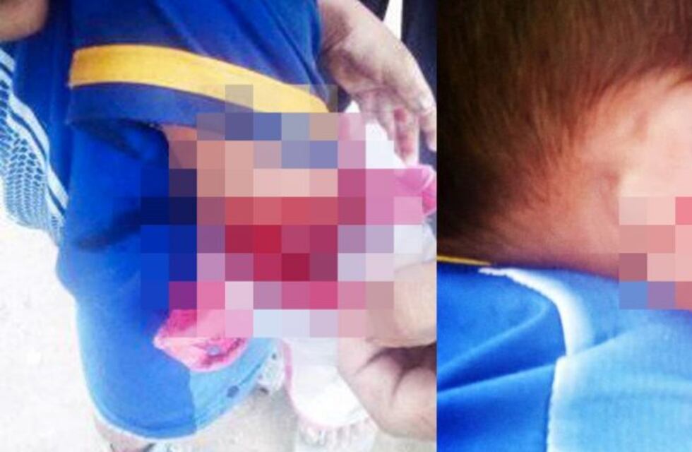 Imputaron a la mujer que atacó a machetazos a sus hijos en Tartagal