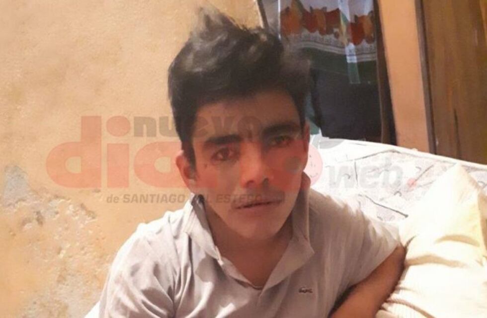 Las Termas: atacaron a un joven en situación de calle con agua hirviendo