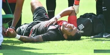 Brian Sarmiento fue retirado de la cancha por una luxo fractura cerrada de tobillo izquierdo\u002E