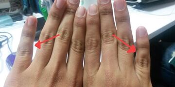 ¿Por qué el dedo meñique está cada vez más alejado del anular?