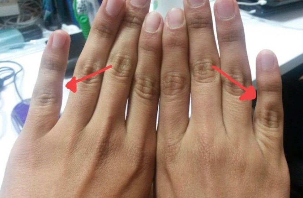 ¿Por qué el dedo meñique está cada vez más alejado del anular?