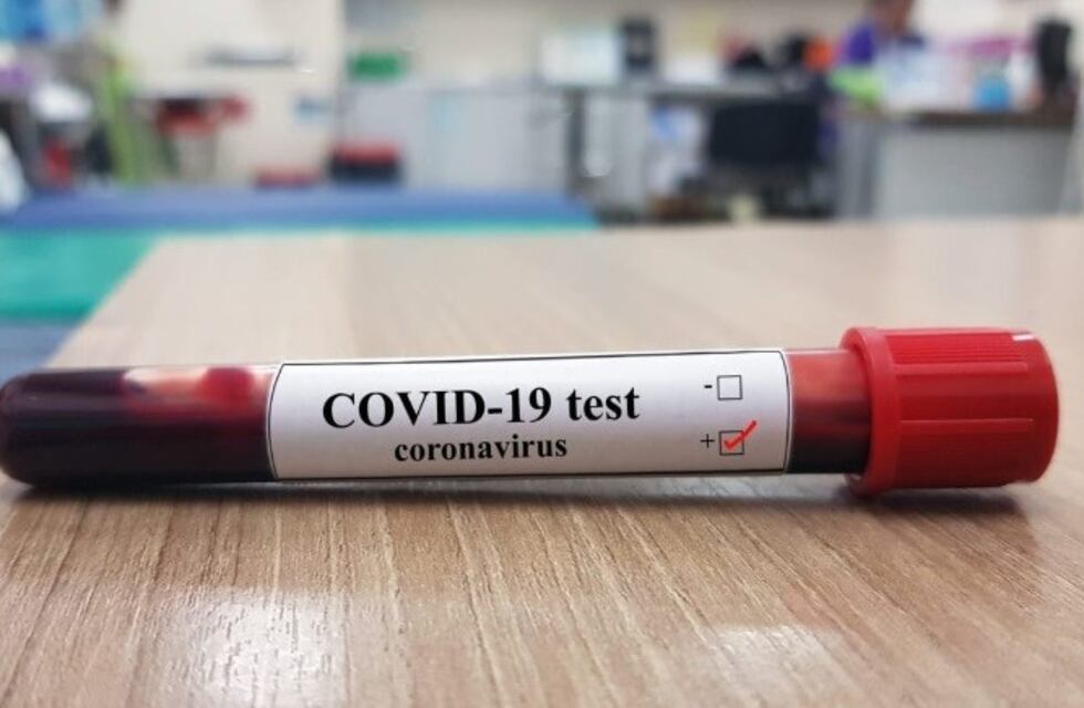 Falleció la segunda persona en Mendoza por coronavirus
