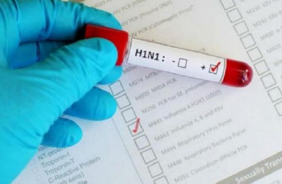 Descartan caso de coronavirus en Oberá: el paciente tiene gripe A