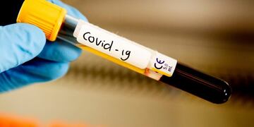 20/03/2020 Muestra de coronavirus en el Hospital Amphia de Breda, en Países Bajos POLITICA INTERNACIONAL Robin Utrecht/SOPA Images via ZU / DPA