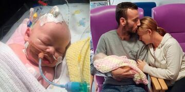 Un beso mató a un bebé y sus padres advierten sobre los peligros del herpes