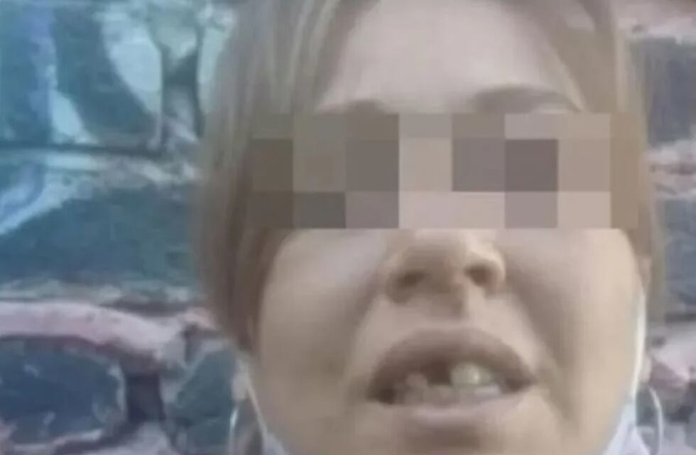 Mandan a prisión a un sujeto que golpeó a su pareja y le quemó la mano con una estufa