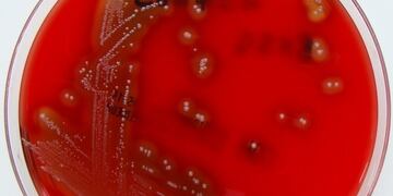 Imagen de la bacteria\u002E