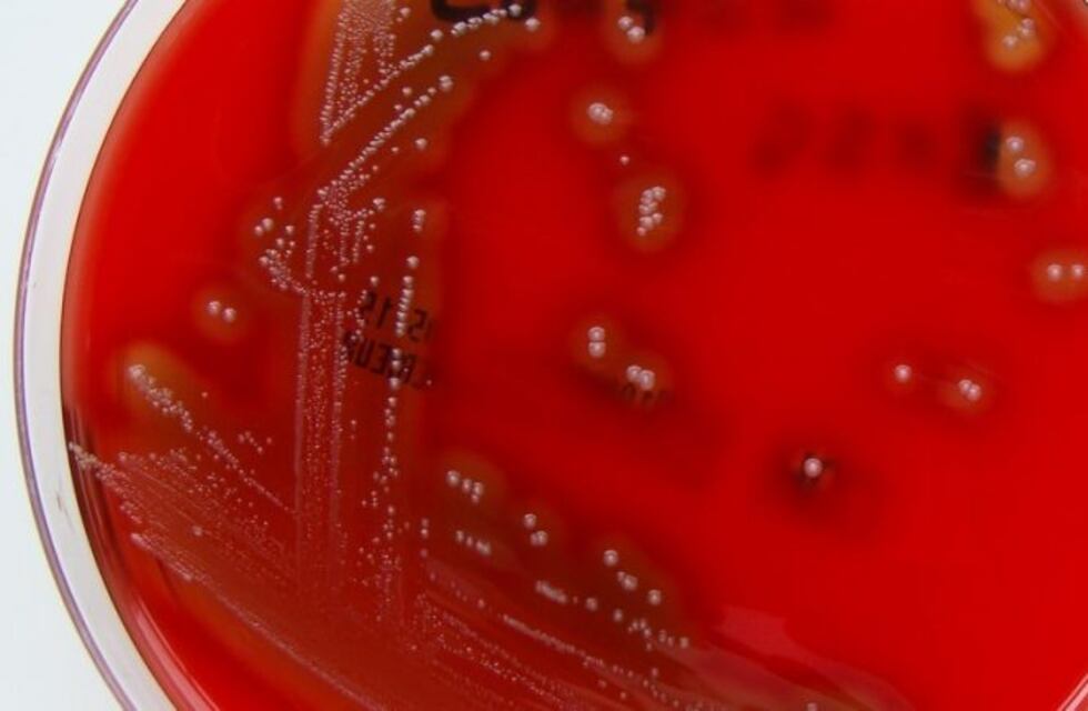 Nuevo caso de Streptoccoco: un chico de 7 años en Santiago del Estero
