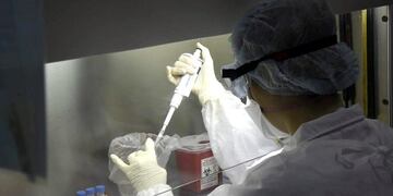 Expertos en infectología realizan test de coronavirus en el Instituto Malbrán\u002E (Ministerio de Salud)