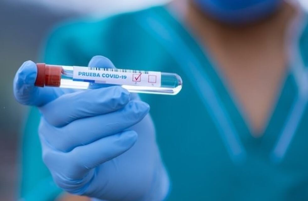 El 20% de los convivientes con enfermos de coronavirus en la Ciudad dio positivo en la prueba de PCR
