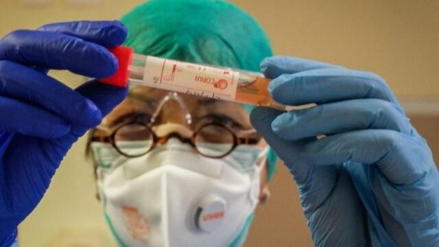 Ante casos de síntomas gripales, se recomienda hacer un test para descartar que sea coronavirus