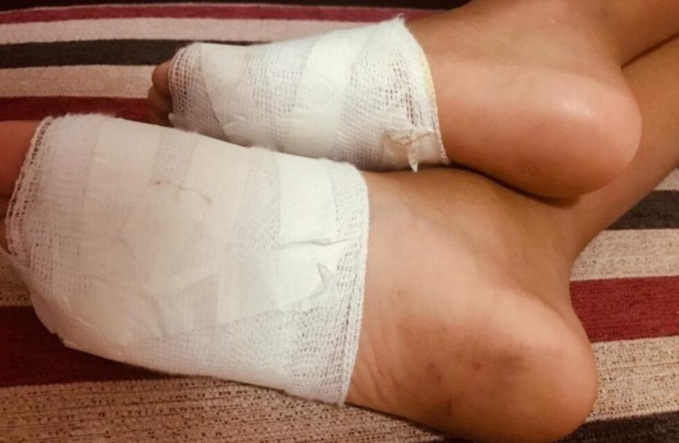 Punta Ancla: "Nos cobraron, pero no avisaron que había ostras"