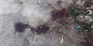 Restos de sangre en el lugar (Cadena3)\u002E