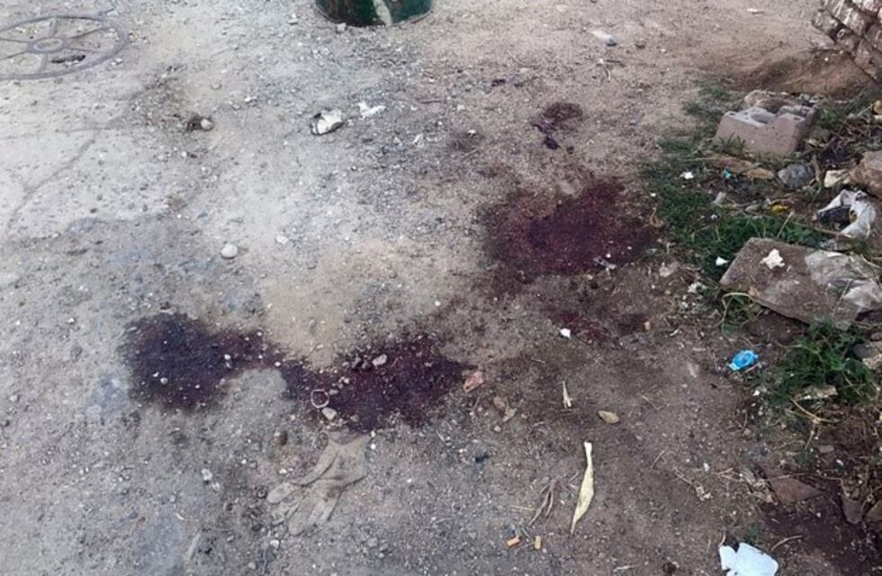 Aguardan la autopsia para saber cómo murió el joven en Villa Siburu